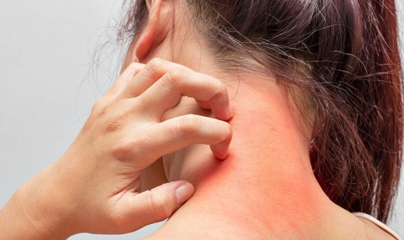 چگونه از حساسیت پوستی به لباس زیر جلوگیری کنیم؟